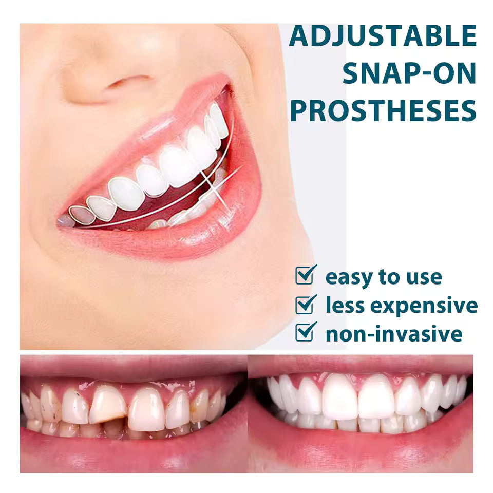 CARILLAS DENTALES FABRICADAS EN RESINA 😍 Superior + Inferior - 80% DESC EN EL SEGUNDO PAR
